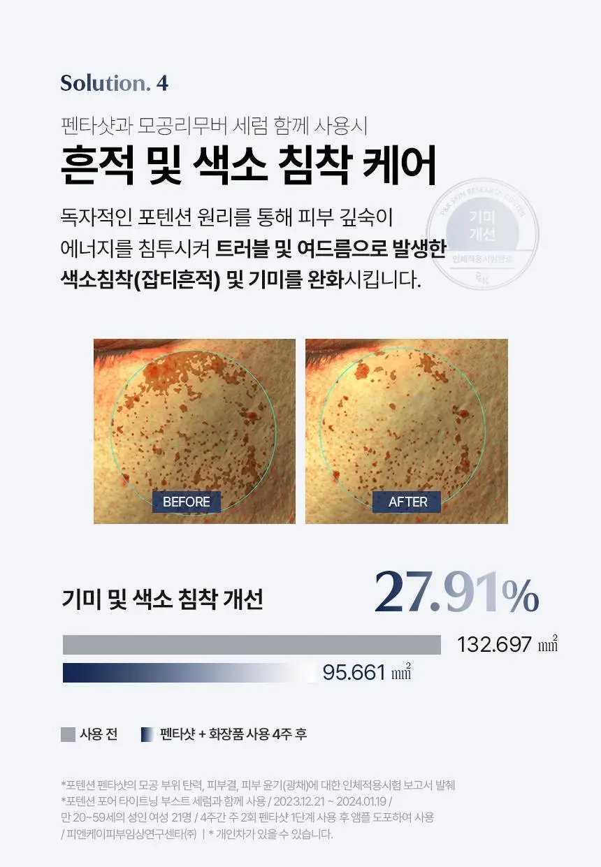 [7중모공케어] 셀로라바이 펜타샷 [기획세트(+모공세럼30ml+파우치)/단품] 상세페이지 26